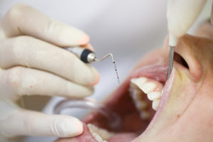 My Dental Education | TLC Periodontal Institute Therapeutic Laser Care
